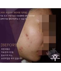 치료 전