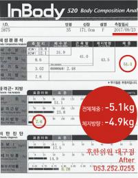 치료 후