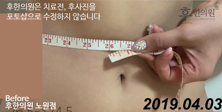 치료 전