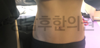 치료 후