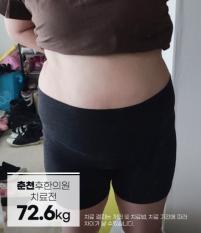 치료 전