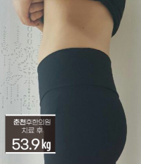 치료 후