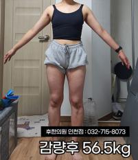 치료 후